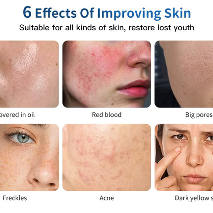 Farbige LED-Gesichts- und Körper-PDT-Maske + Kalt-Nano-Spray