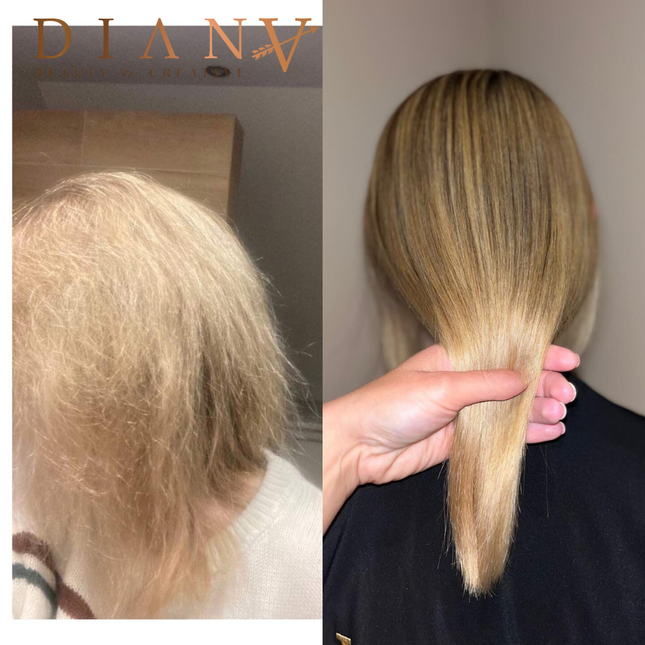 PreNano HaarBotox – Soin réparateur intensif et nourrissant en profondeur 1000 ml