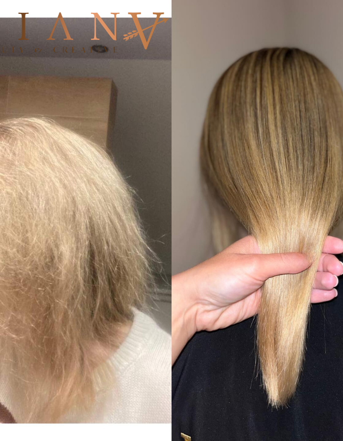 <h2>Bekijk het effect</h2>